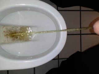 Goldenshower